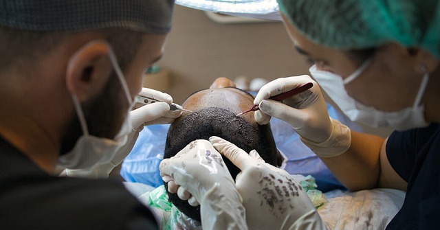 FUE hårtransplantation: Hvad kan du forvente af resultatet?